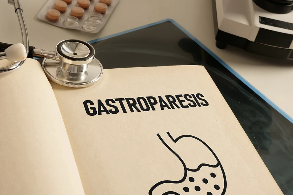 gastropareza